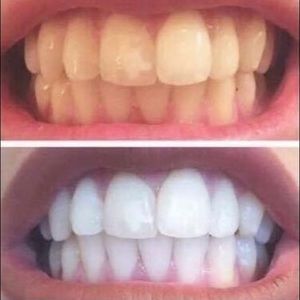 Ap24 whitening toothpaste